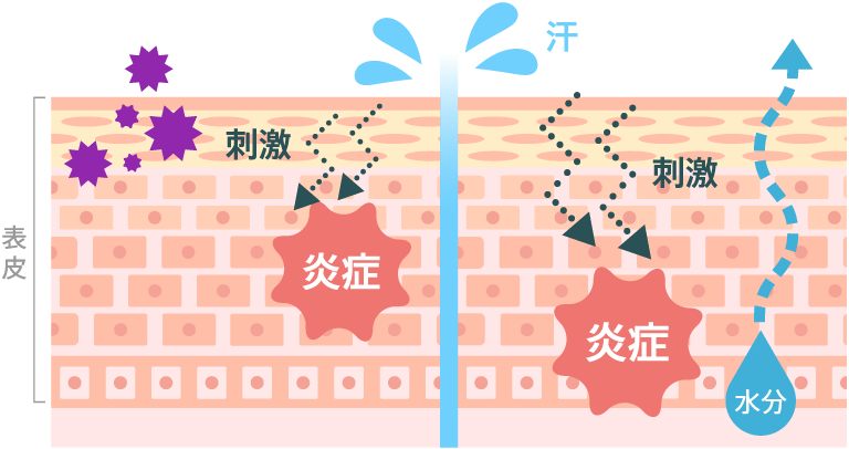 汗による肌トラブルの原因